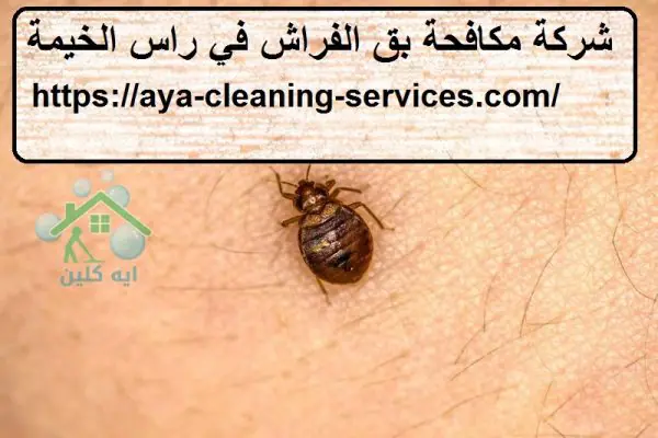 شركة مكافحة بق الفراش في راس الخيمة